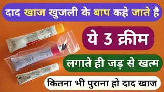 दाद खाज खुजली के बाप है 3 दिन में जड़ से खत्म करे | 3 Best Fungal Cream For Dad Khaj Khujli Problem