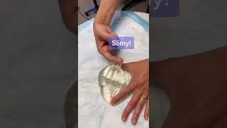 What Happens When You Touch the Inside of a Silicone Implant! #shorts #siliconeimplants