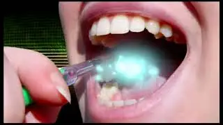Soladey-Eco ionic Toothbrush 🪥 &hearts;