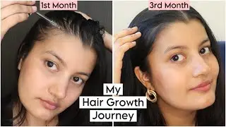 My 3 Months Experience of Using the  Advanced Hair Growth serum