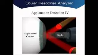 Jak działa Ocular Response Analyzer?