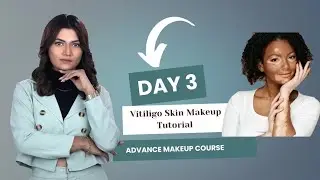 Vitiligo skin makeup tutorial @janvimakeupart makeupmasterclass #makeuptutorial #makeup #makeupart 