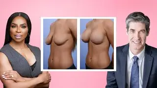 Busting 10 myths about breast implants, Plastic surgeon explained