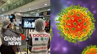 Беспокоитесь о вирусе Нипах? Что нужно знать об этой инфекции, как врачи оценивают риск в Канаде?