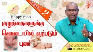 குழந்தைகளுக்கு தொடையில் ஏற்படும் புண் | Nappy rash in babies problem | Dr. Dhanasekhar Kesavelu