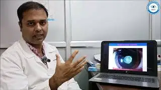 Dr. Raghudev Bhattacharjee Explains Cataract Surgery | Drishti Darpan Eye Care Clinic Agartala