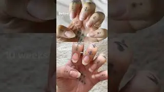 FIXING MY NAILS with oil - RESULTS #nailcare