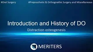 NEET MDS | INI-CET | Oral Surgery | Distraction Osteogenesis | Introduction and History of DO