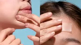 Mighty Patch Micropoint Large Hydrocolloid Pimple Patches for Face Blemishes from Hero Cos