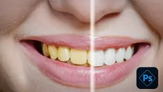Best WAY To Whitening Yellow Teeth | Photoshop Tutorial