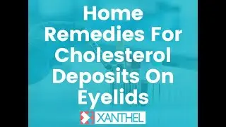Home Remedies For Cholesterol Deposits On Eyelids - Brought To You By XANTHEL&reg;