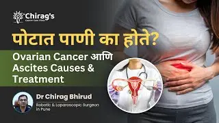 पोटात पाणी का होते? | Ovarian Cancer आणि Ascites Causes & Treatment | Dr. Chirag Bhirud