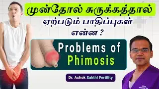 10 Problems of Phimosis | முன்தோல் சுருக்கத்தால் ஏற்படும் பாதிப்புகள் என்ன ?
