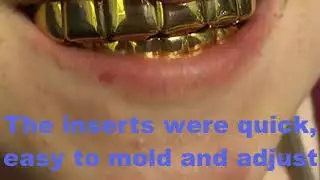 Gold Hip Hop Grillz Top & Bottom Teeth Set