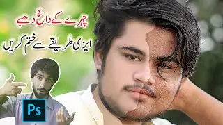 How to Remove Acne in Photoshop (Urdu Hindi)/remove acne from photo/acne removal photo
