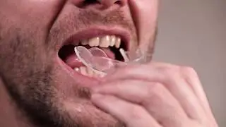 How to mold teeth whitening trays at home