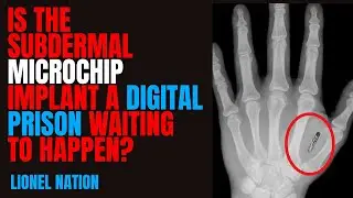Is the Subdermal MICROCHIP Implant a Digital Prison Waiting to Happen?