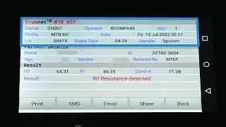 Reading the Results of Truenat MTB RIF Test
