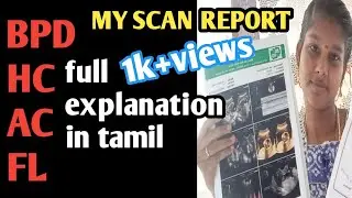 BPD,FL,AC,HC measurements in scan report/ஸ்கேன் பரிசோதனையில் BPD,AC,HC,FL என்றால் என்ன?/tamil