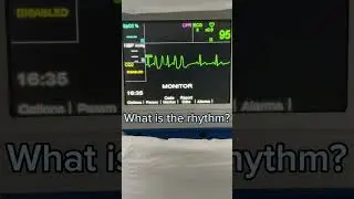 What is the rhythm? EP.1 #shorts #ekg  #ecg #frontlineekg
