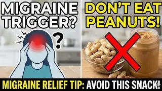 Stop Eating Peanuts If You Have Migraines! 🥜