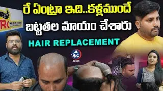 Hair Patch Fixing For Men | Non Surgical Hair Replacement | Rk Hair Studio | Mic TV News
