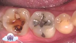 Dental Mistake Number One