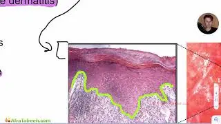 Vaginal Skin Pathology atf