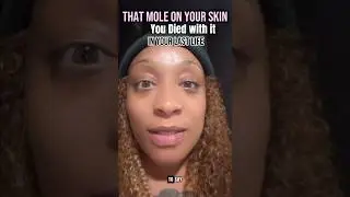 #BirthmarkTheory #MoleReading #PastLifeHealing #ElonMuskTruth #soulmarks #molemeaning #birthmark