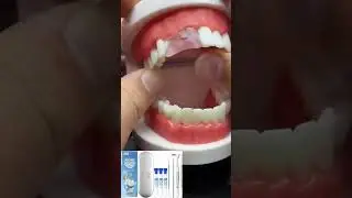 JXE JXO moldable false teeth, tooth repair kit for broken teeth, missing teeth, yellow teeth #fix