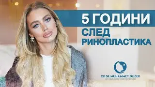 5 години след ринопластика
