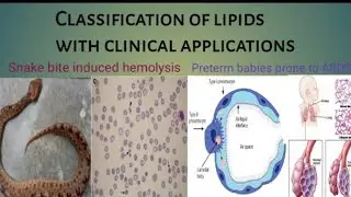 Classification of Lipids | Chemistry of lipids part 3