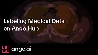 Labeling Medical Data on Ango Hub - Walkthrough