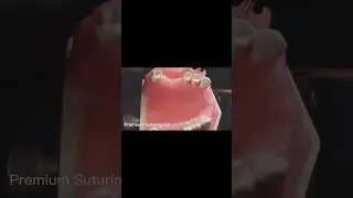 The design of the trapezoidal flap