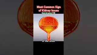 Most common sign of kidney issues #health #facts #science #shorts #foryou #doctor #kidneyhealth