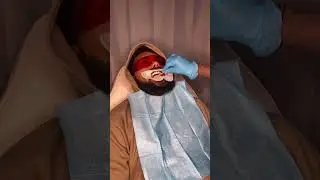 Teeth Whitening Service