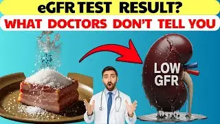 eGFR Test Explained: What Your Creatinine Levels Really Mean