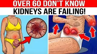 OVER 60: 10 Silent Signs Your Kidneys Are FAILING (What Your Body is Trying to Tell You)