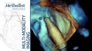 New Frontiers in Structural Heart Disease Imaging (Nadeen N. Faza, MD) November 24, 2020