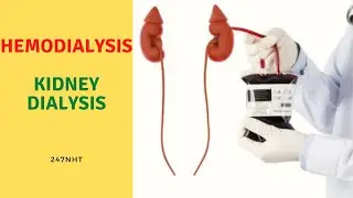Hemodialysis - What Is Hemodialysis? - What happens to your blood during hemodialysis? | 247nht