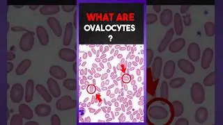 Что такое &laquo;овоциты&raquo; 🩸? | Понятное объяснение