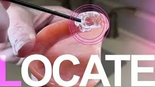 Denture Sore Spot Find And Remove