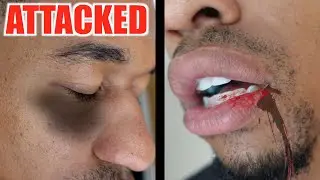 ATTACKED BY A FAN | STORYTIME