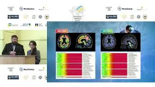 IHS 2025: Prosthetics and Rehabilitation Beyond VR therapy neuro immersive environments