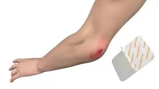 How to use Primapore Adhesive Dressing? | Wound Dressings