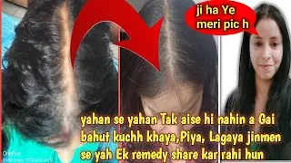 Hair Regrowth Journey Me Journey Me In Hair Mask Ne Help Ki Meri ❤️/Shiny, Dandruff Free & Hairfall.