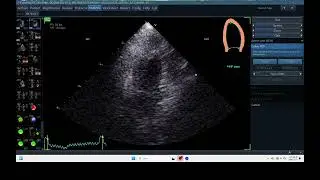 IQ 341 AUTOEF ECHOPAC ANALYSIS HWD ECHOCARDIOGRAPHY FS 21