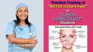 Botox Treatment - Crow's Feet - Training to DNCC Academy Students