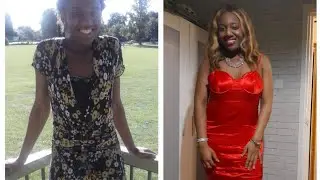 My anorexia story as a teen and how I recovered. Black women and eating disorders