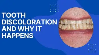 Dentistry 101: Tooth Discoloration and Why It Happens | Dental House MI